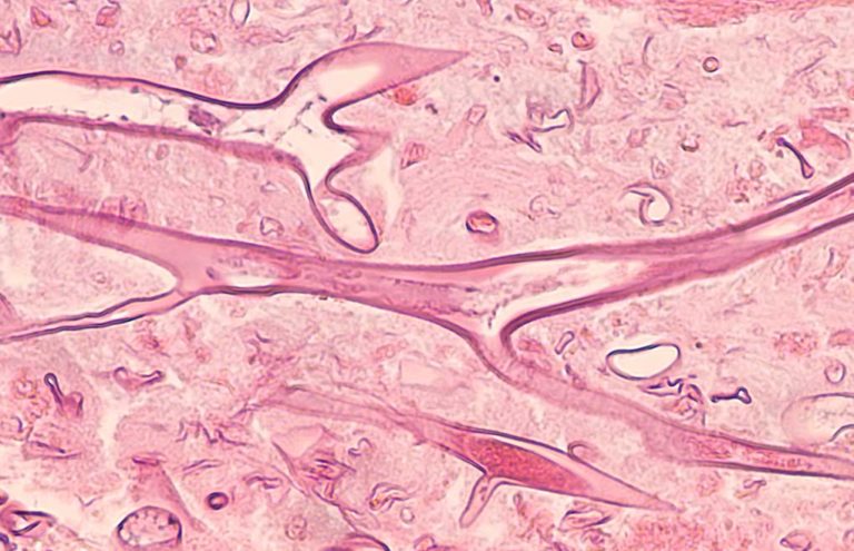 Citologia nasale: quando la scienza diventa arte