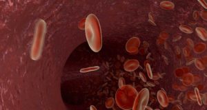 Trigliceridi alti: le cause secondarie dell’Ipertrigliceridemia