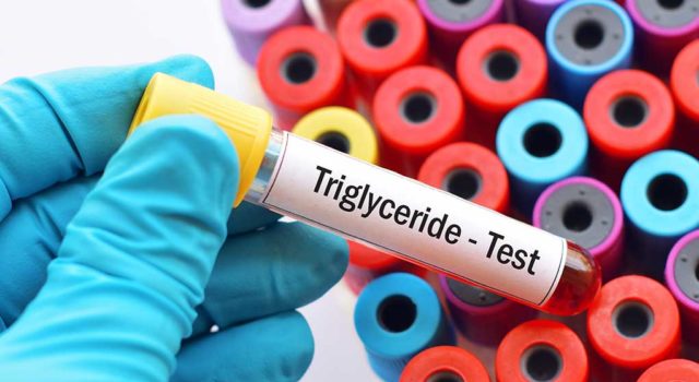 Trigliceridi alti: come orientarsi nella terapia