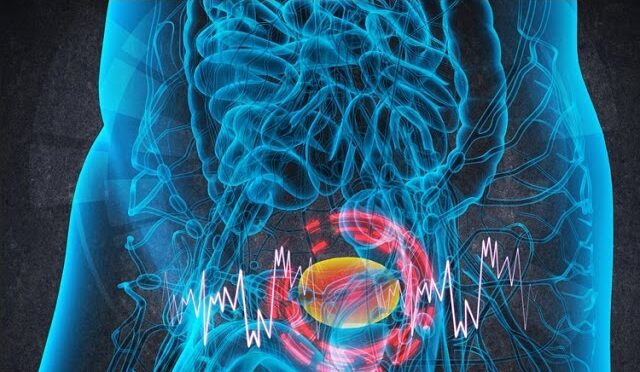 Infiammazione cronica della vescica: rischio tumore