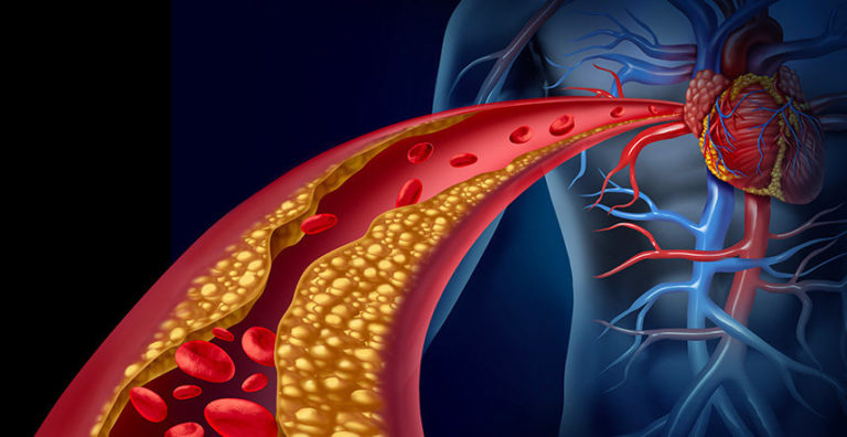 Cistite: come curarsi senza gli antibiotici