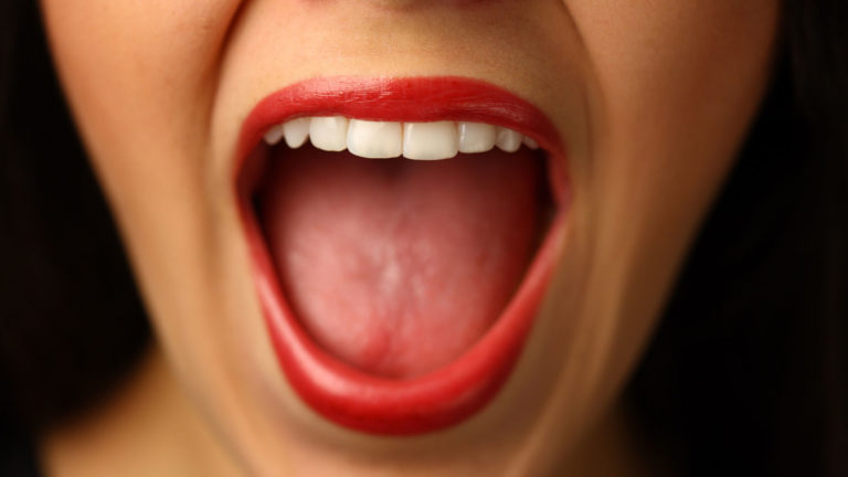 Sindrome della bocca urente