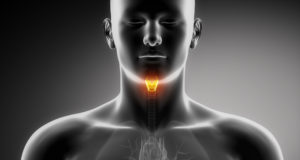 Il gozzo: quando la tiroide è ingrossata