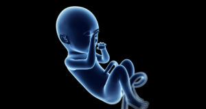 Ipotiroidismo congenito: di cosa si tratta?