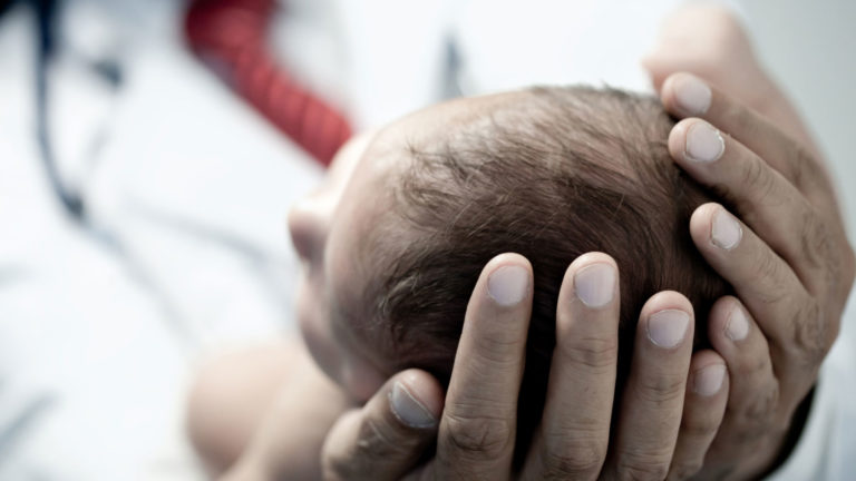 Ipotiroidismo congenito: lo screening neonatale
